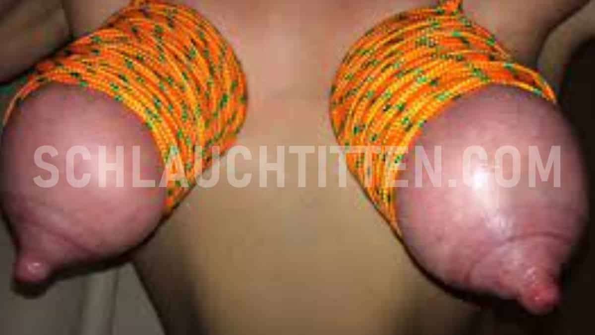 Abgebundene Schlauchtitten in denen sich das Blut staut